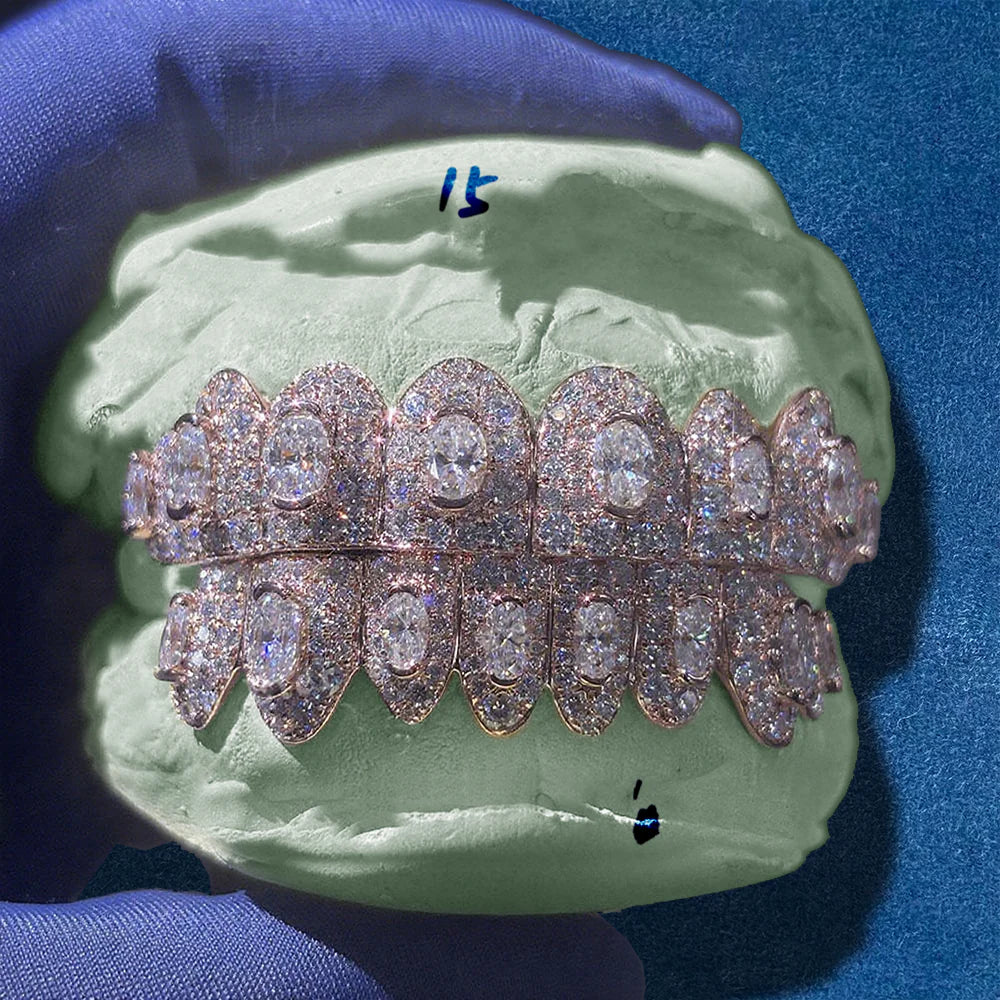 Custom Iced-Out VVS Moissanite Grillz – 925 Sterling Silver with Large Center Moissanite Stone for Men & Women